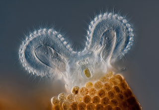 Illustration for article titled Parasites, deadly bugs and fungi are more beautiful than you could possibly imagine